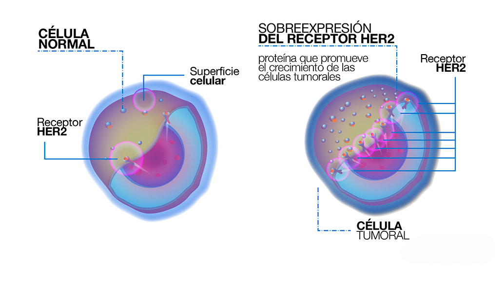 proteína HER2 cáncer de mama